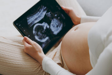 Frau mit Ultraschallbild ihres ungeborenen Kindes.